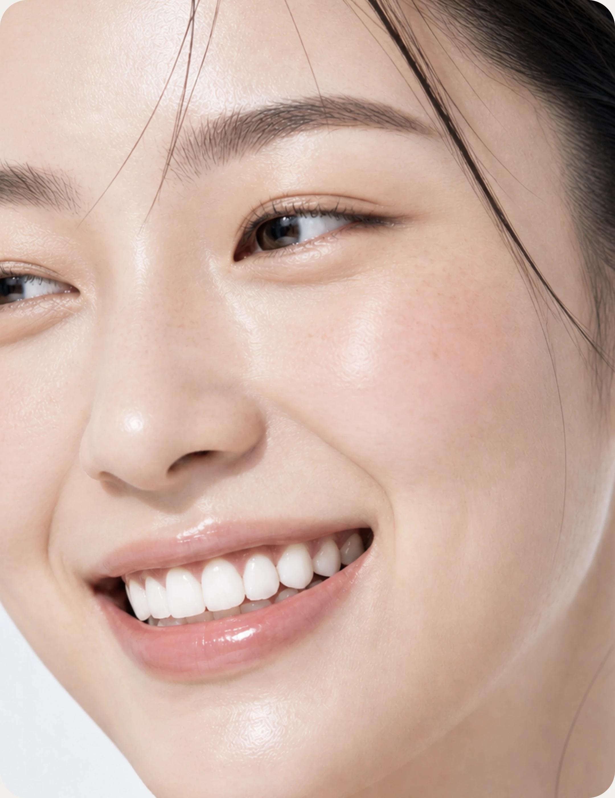 라미네이트 치료를 마치고 웃는 여성의 앞니 근접 사진