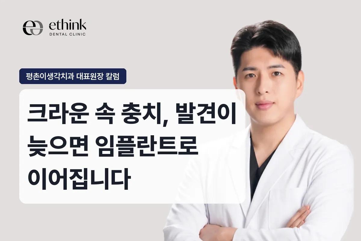 크라운 속 충치, 발견이 늦으면 임플란트로 이어집니다