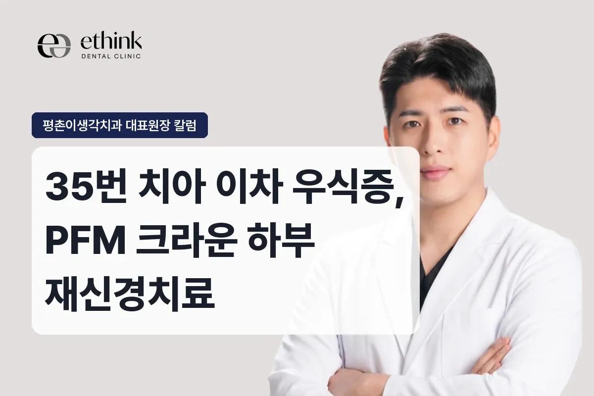 35번 치아 이차 우식증, PFM 크라운 하부 재신경치료