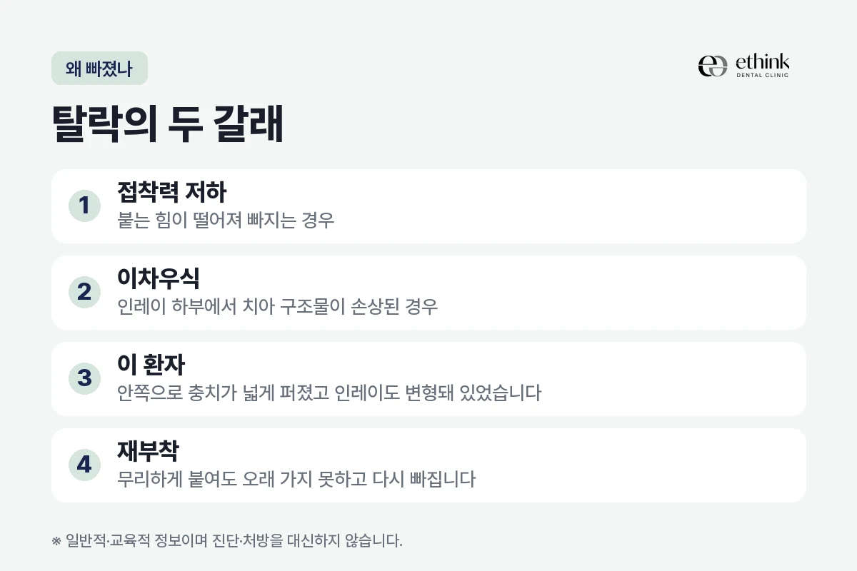 인레이가 탈락하는 두 가지 원인을 정리한 도해