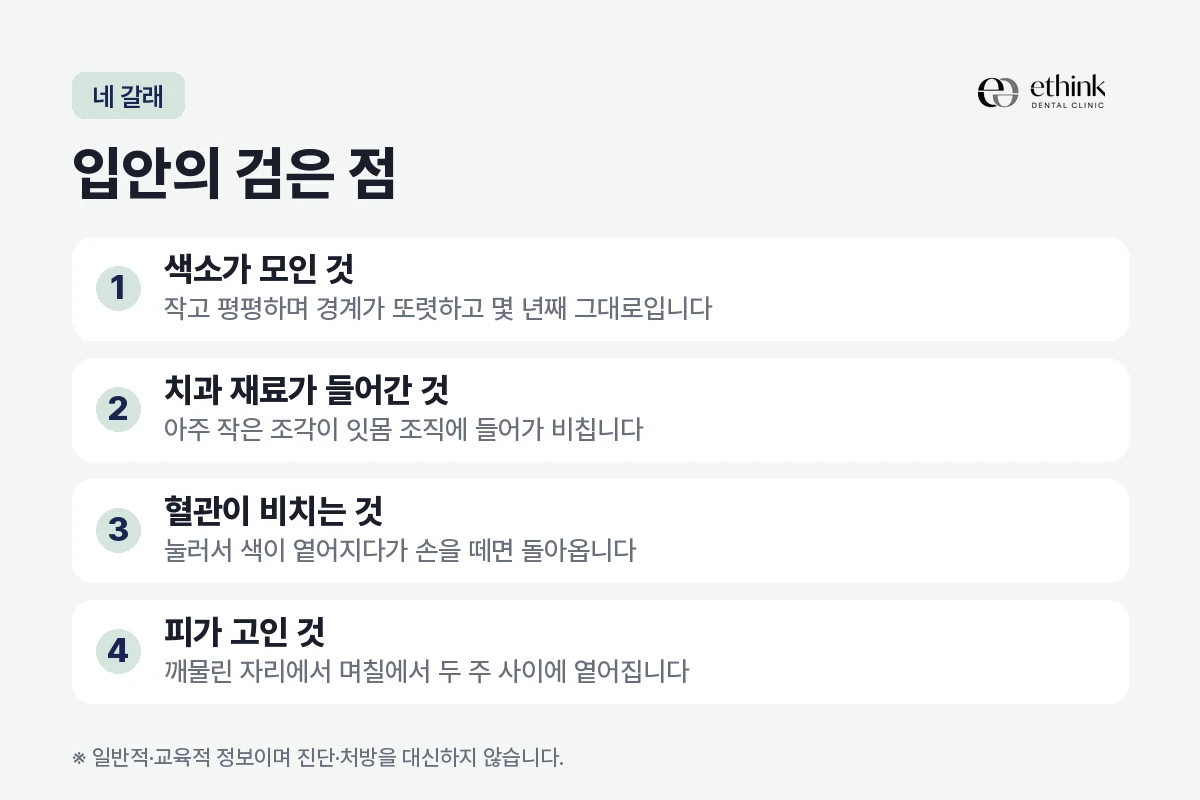 입안의 검은 점을 색소가 모인 것·치과 재료가 들어간 것·혈관이 비치는 것·피가 고인 것 네 갈래로 정리한 도해