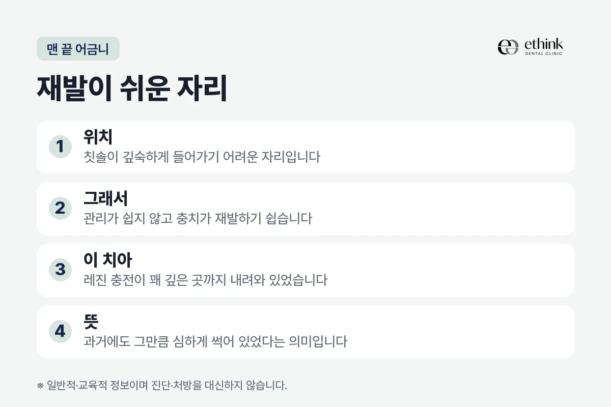 맨 끝 어금니가 관리가 어렵고 충치가 재발하기 쉬운 이유를 정리한 도해