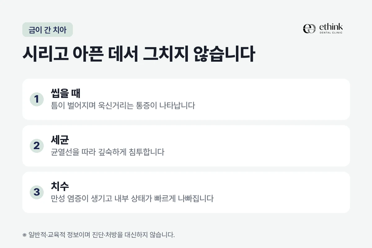 치아에 금이 갔을 때 균열선을 따라 세균이 침투하는 과정을 정리한 도해