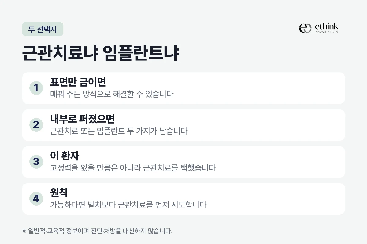 금이 간 치아에서 근관치료와 임플란트 중 무엇을 택할지 가르는 기준을 정리한 도해