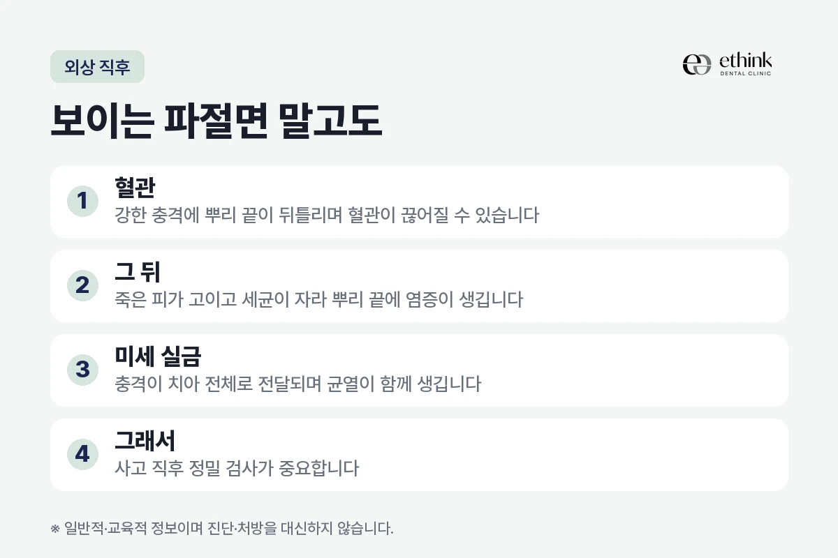 앞니 외상에서 눈에 보이는 파절면 외에 함께 살피는 것을 정리한 도해