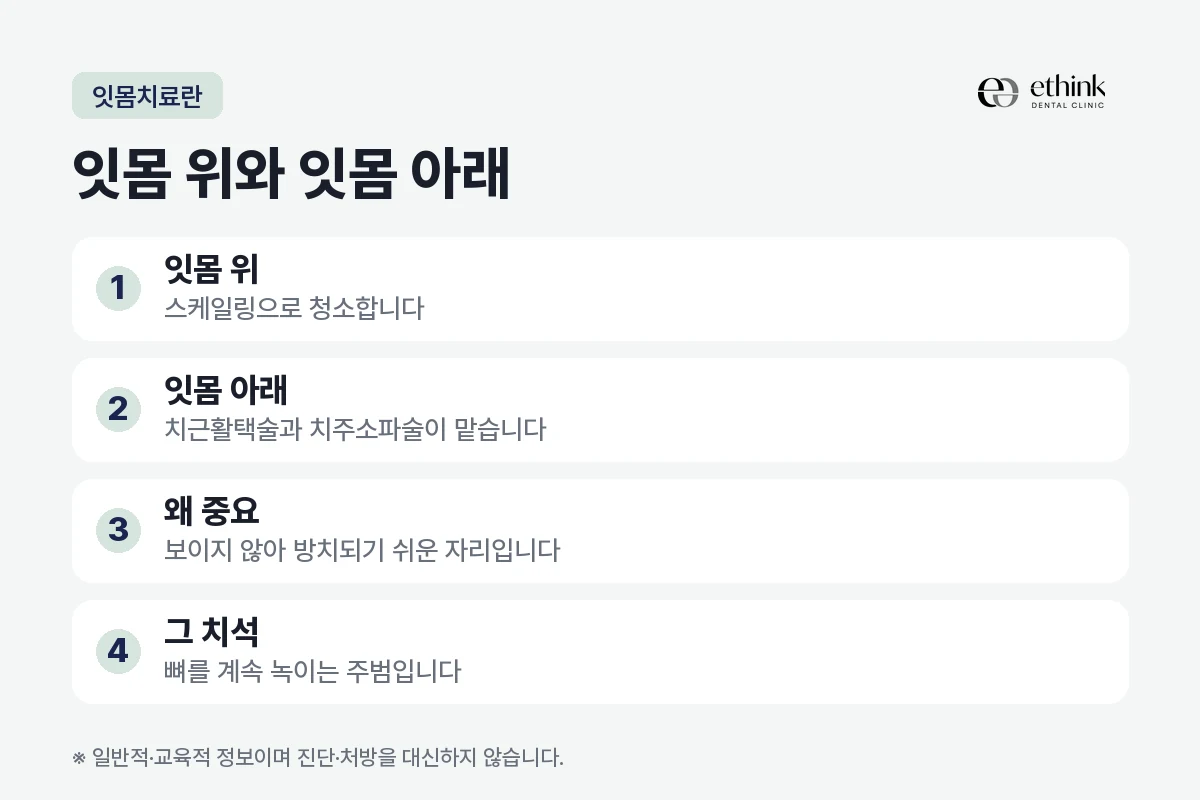 잇몸 위와 잇몸 아래로 나뉘는 잇몸치료 시술을 정리한 도해
