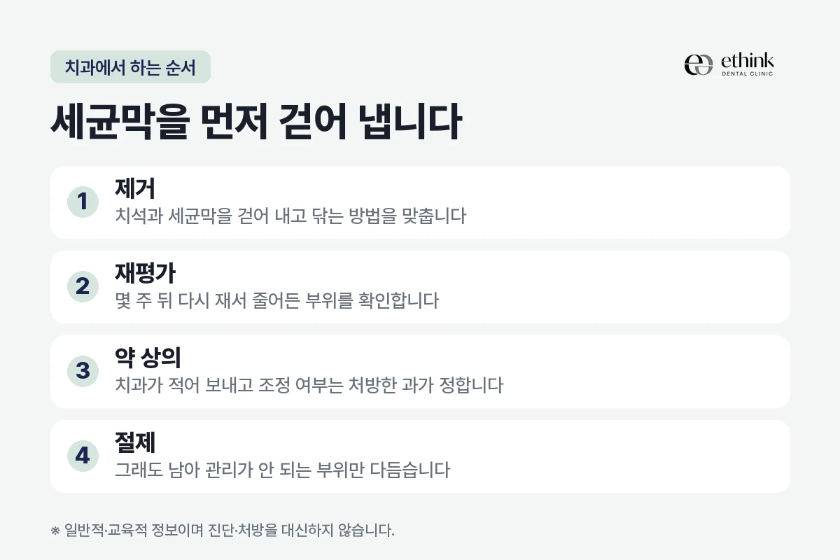 잇몸 증식 치료를 제거·재평가·약 상의·절제 네 단계로 정리한 도해