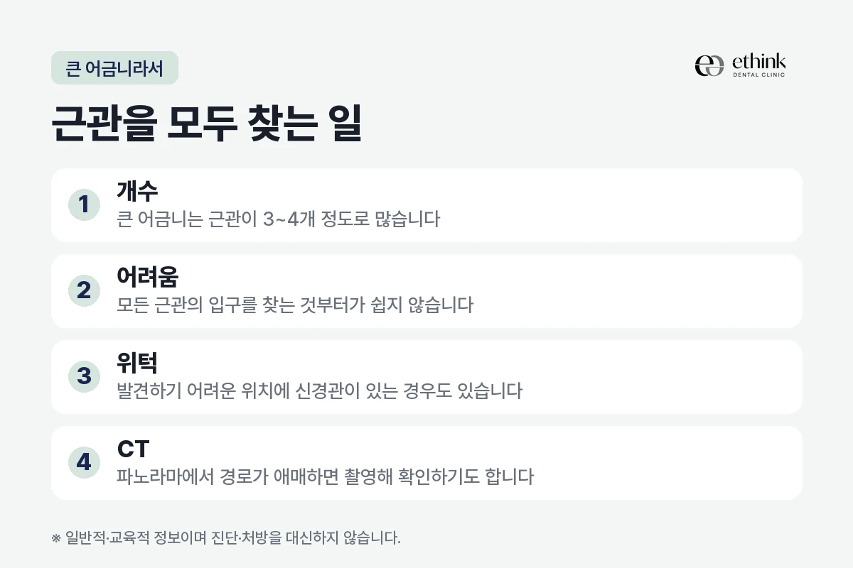 큰 어금니 신경치료에서 근관을 모두 찾는 일이 어려운 이유를 정리한 도해