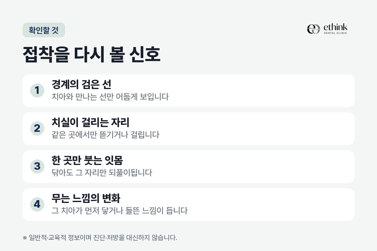 라미네이트 접착이 약해졌을 때 나타나는 네 가지 신호를 정리한 도해