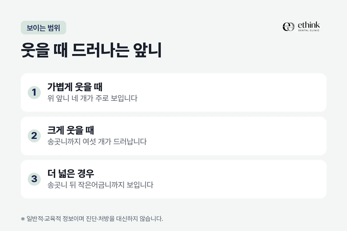 가볍게 웃을 때와 크게 웃을 때 드러나는 위 앞니의 범위를 정리한 도해