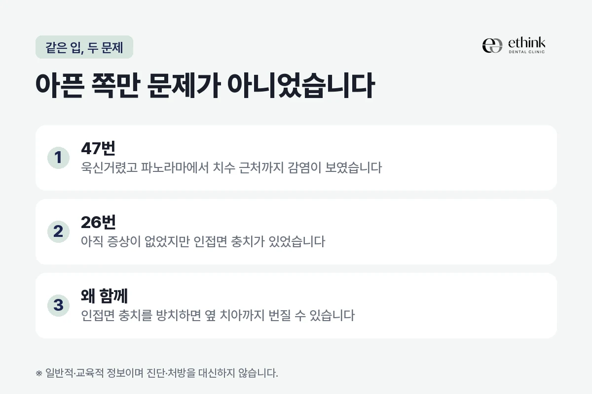 증상이 있던 어금니와 증상이 없던 어금니를 함께 처치한 이유를 정리한 도해