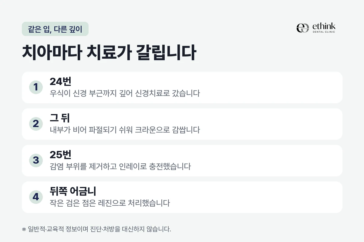 한 환자의 네 치아에서 치료 방법이 갈린 기준을 정리한 도해