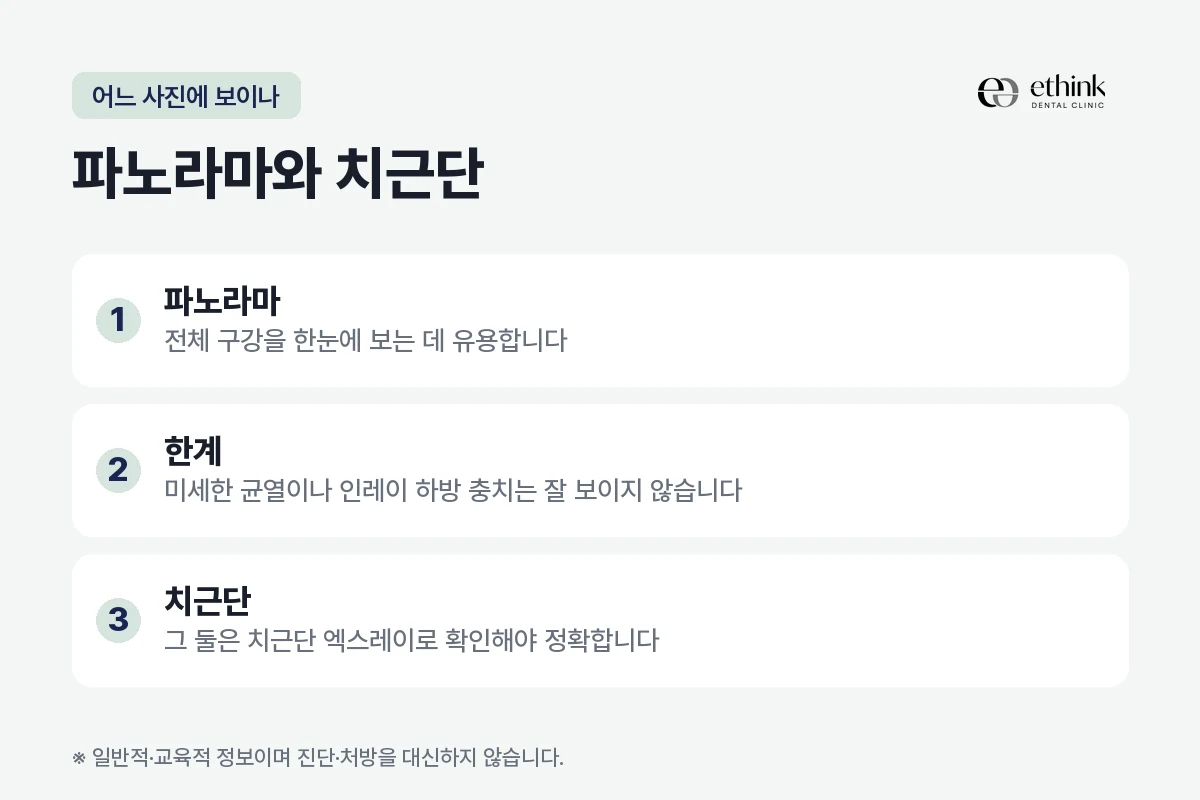파노라마와 치근단 엑스레이가 각각 무엇을 보여 주는지 비교한 도해