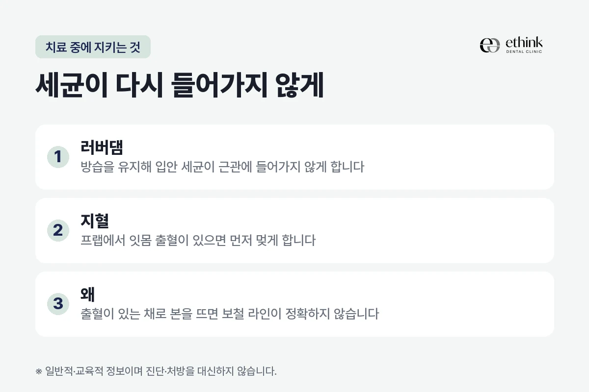 신경치료와 본뜨기 과정에서 지키는 두 가지를 정리한 도해