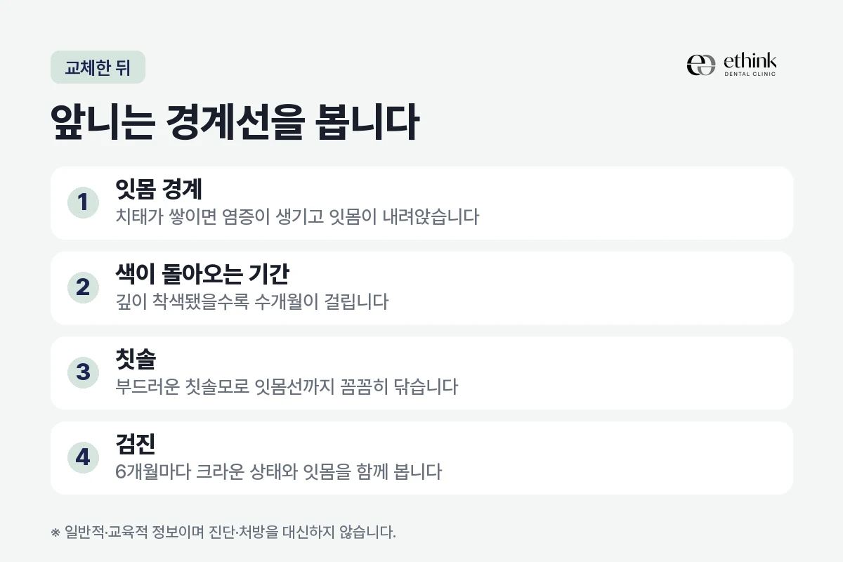 앞니 크라운을 교체한 뒤 잇몸 경계에서 살필 네 가지를 정리한 도해