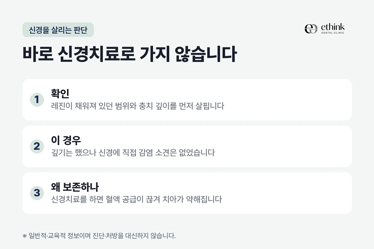 레진 탈락 뒤 생긴 충치에서 신경치료 여부를 가르는 판단을 정리한 도해