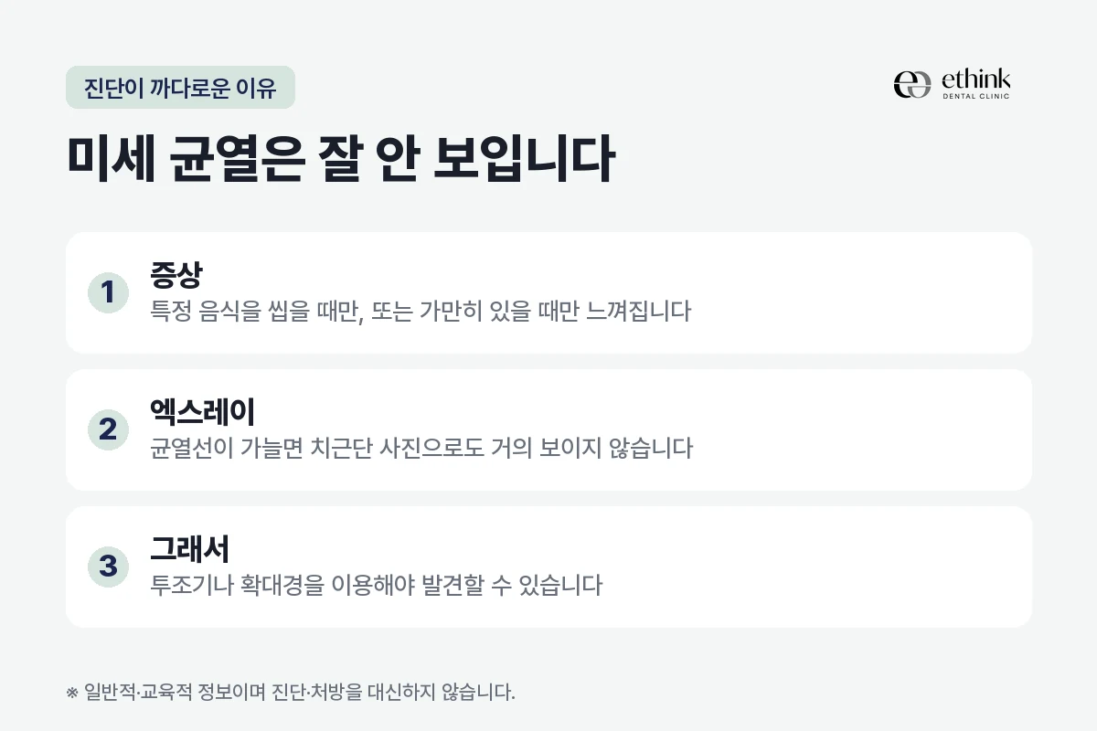 치아 미세 균열이 진단하기 까다로운 이유를 정리한 도해
