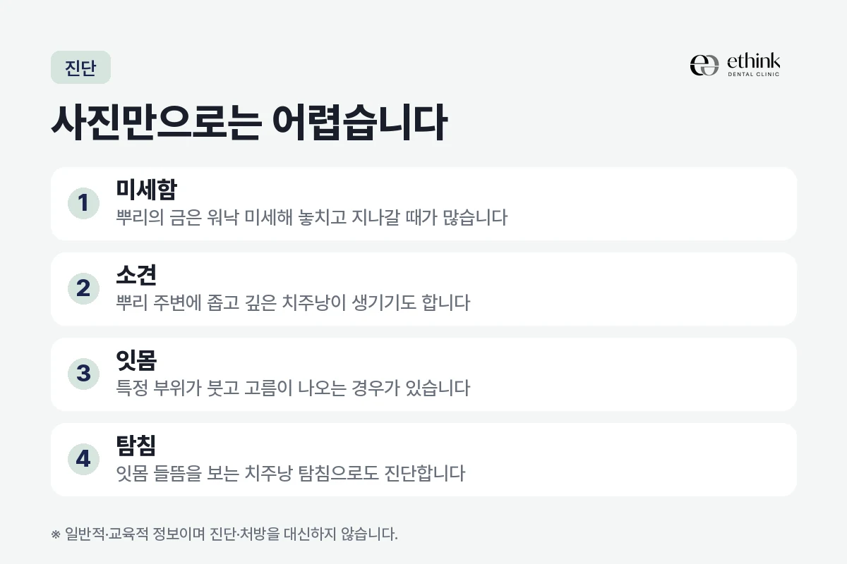 수직 치근 파절을 진단할 때 보는 소견과 검사 방법을 정리한 도해
