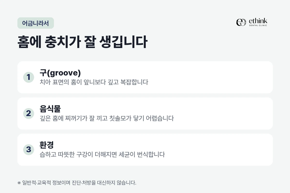 어금니 표면의 깊은 홈 때문에 충치가 잘 생기는 이유를 정리한 도해