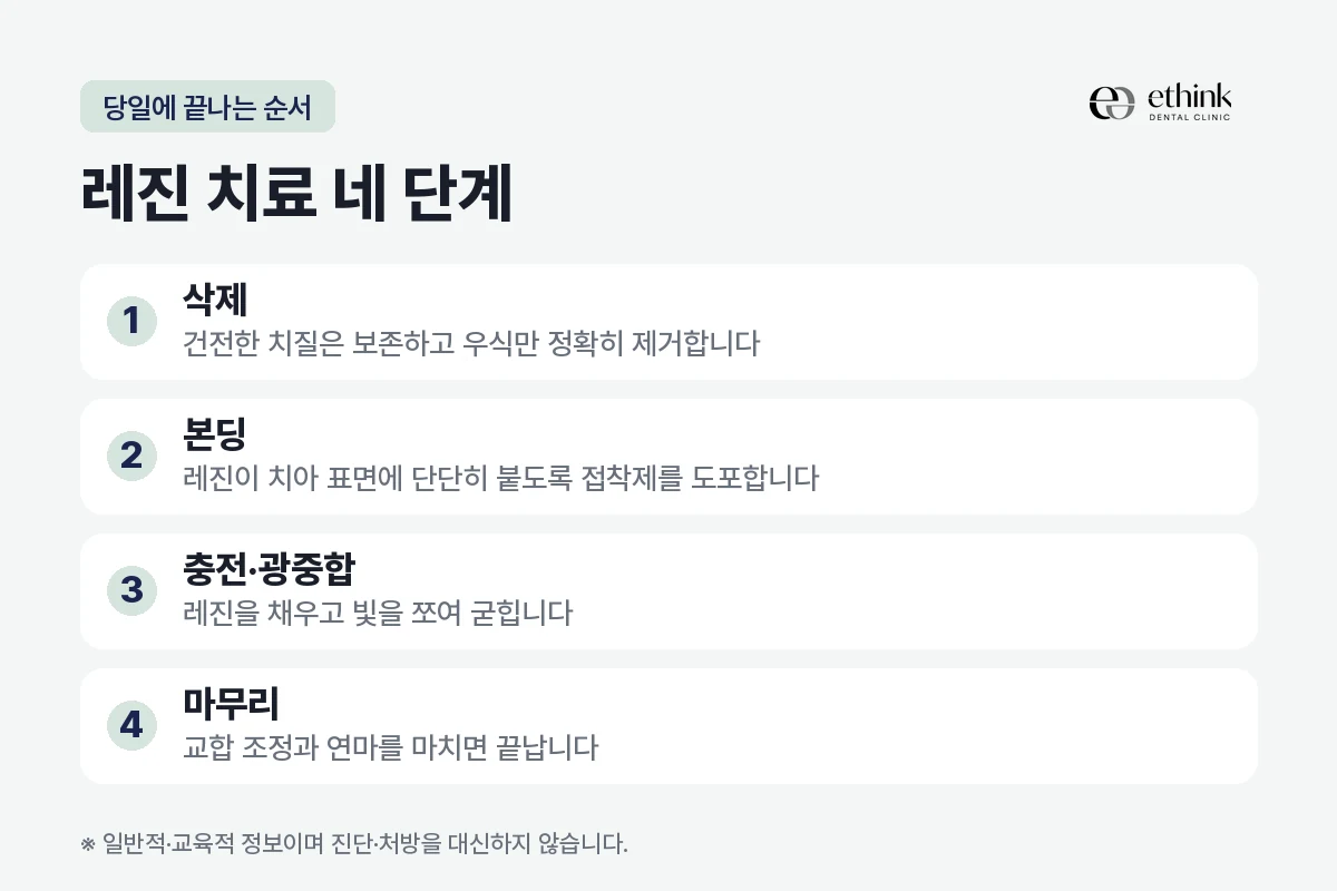레진 수복이 당일에 끝나는 네 단계를 정리한 도해