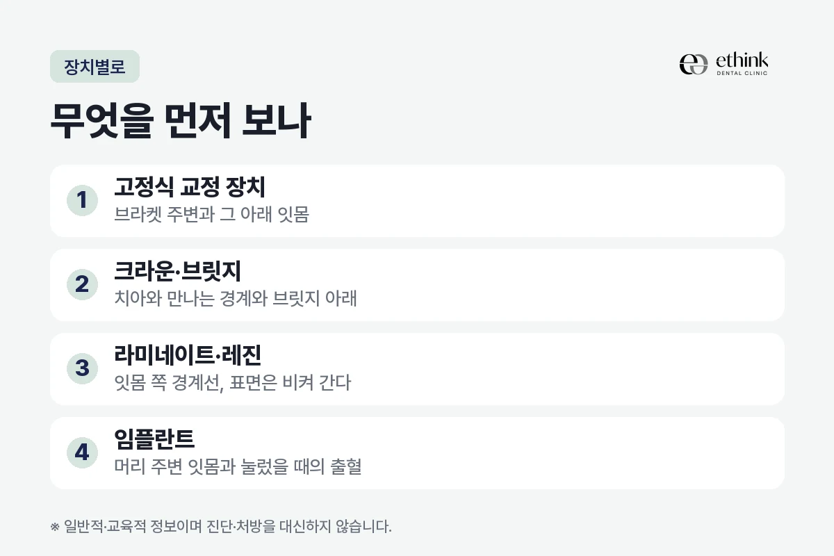 고정식 교정 장치와 크라운·브릿지, 라미네이트, 임플란트에서 스케일링 때 먼저 보는 자리를 정리한 도해