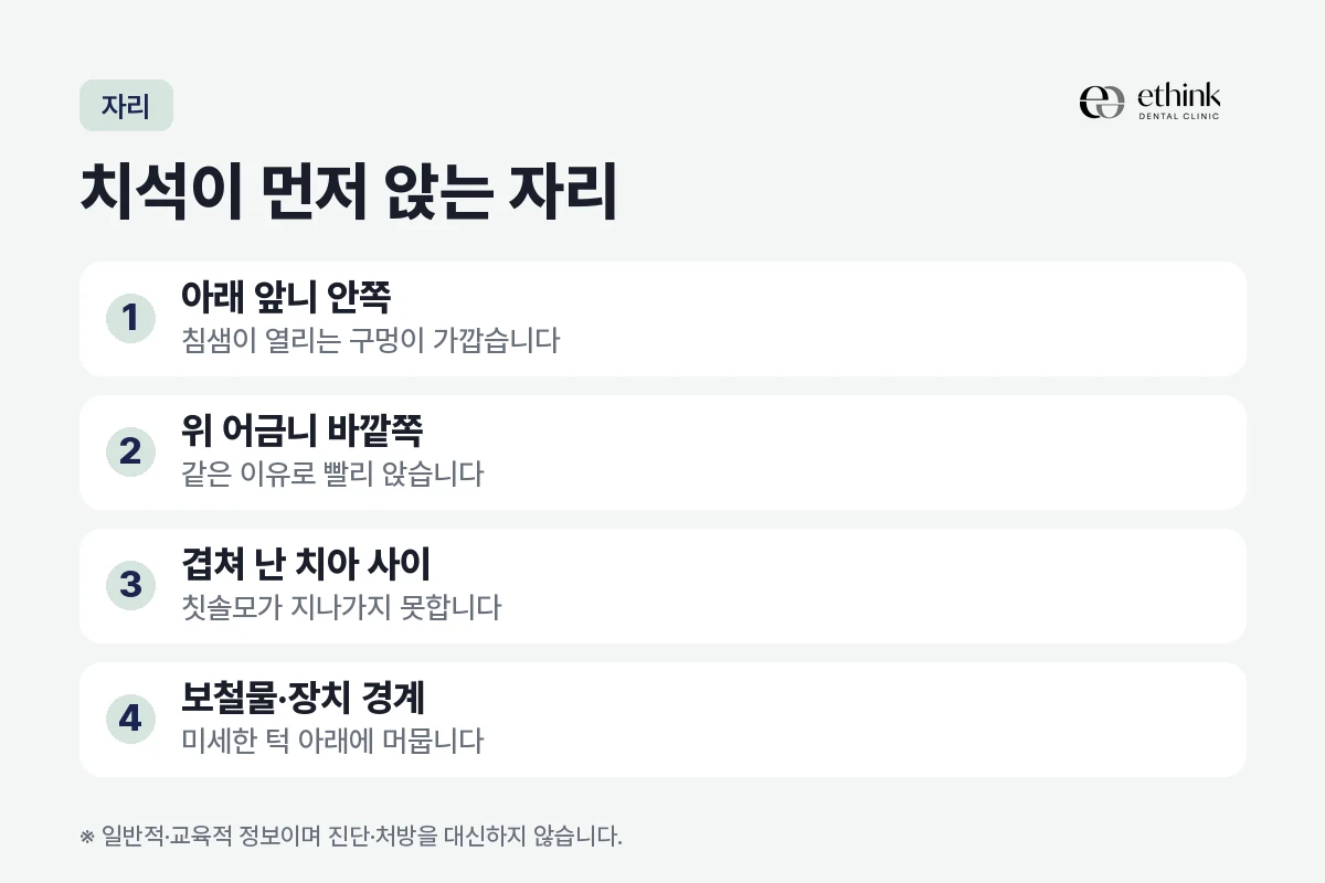 아래 앞니 안쪽과 위 어금니 바깥쪽, 겹친 치아 사이, 보철물과 장치 경계에 치석이 먼저 앉는 이유를 자리별로 정리한 도해
