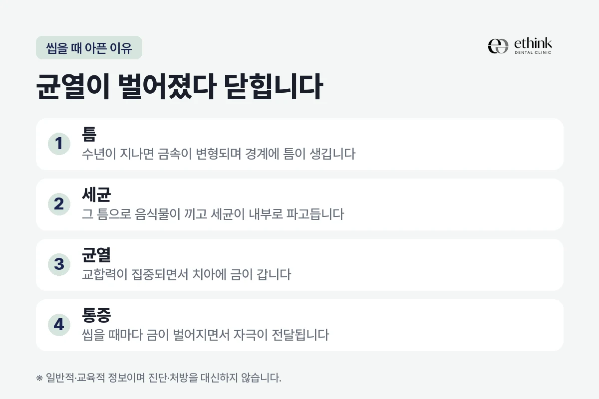 금 인레이 틈에서 시작된 균열이 씹을 때 통증을 만드는 과정을 정리한 도해