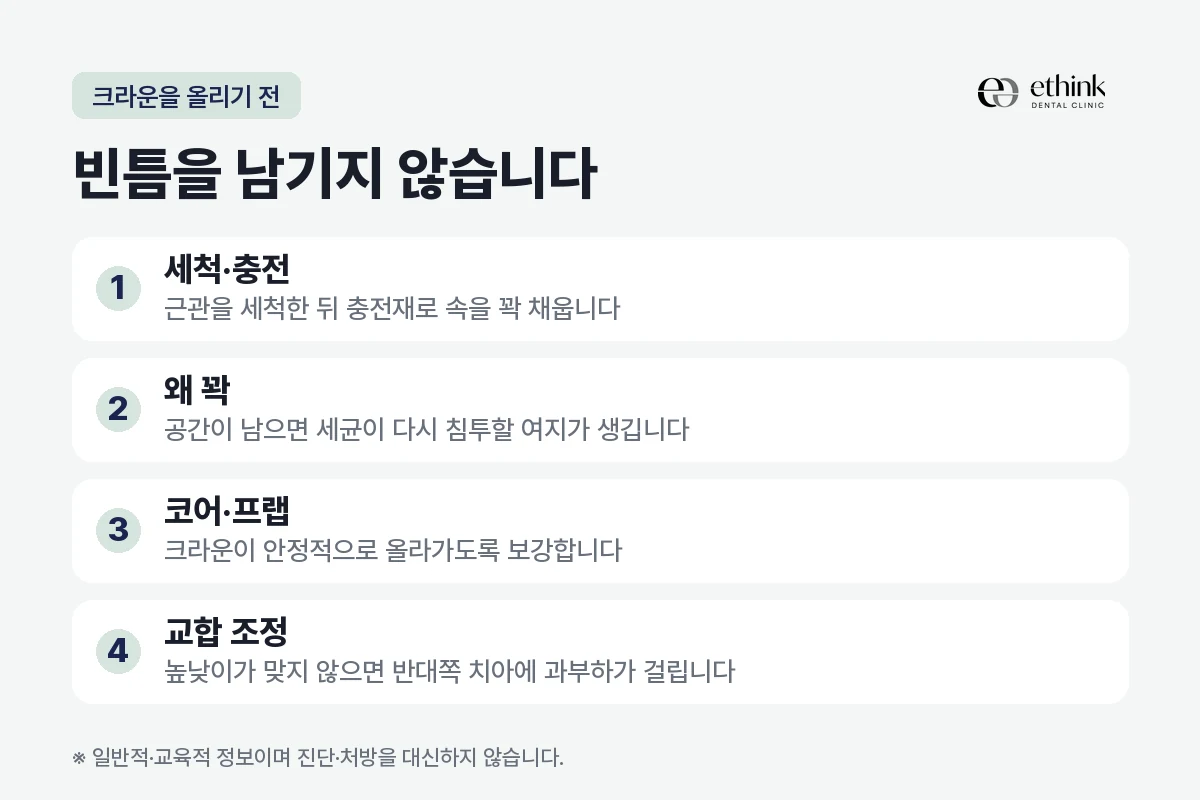 신경치료 뒤 크라운을 올리기까지 거치는 단계를 정리한 도해