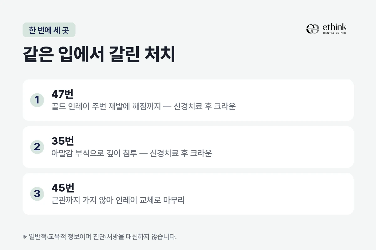 8년 만에 검진한 환자의 세 치아에서 처치가 갈린 기준을 정리한 도해