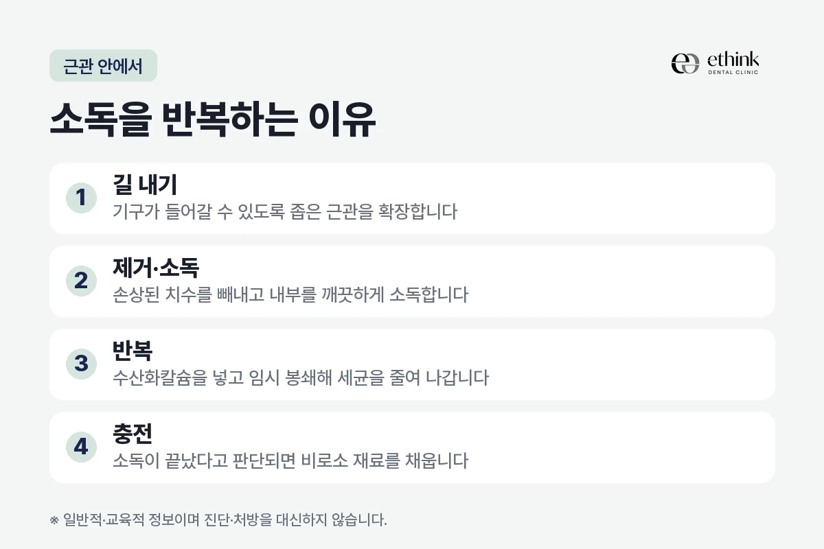 신경치료에서 근관을 소독하고 충전하기까지의 순서를 정리한 도해