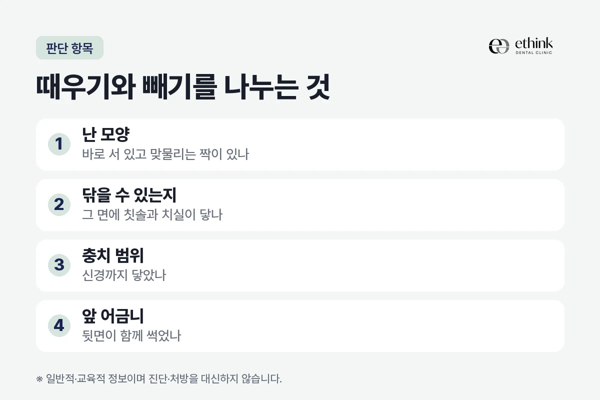 사랑니 충치를 때우는 쪽과 빼는 쪽을 나눌 때 보는 네 가지 항목을 정리한 도해