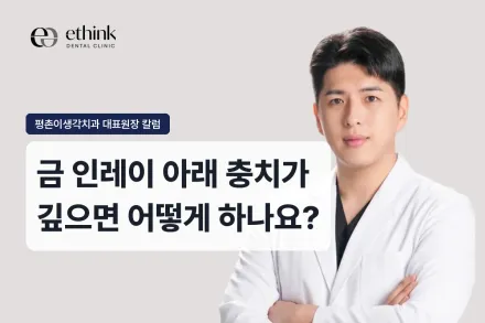금 인레이 아래 충치가 깊으면 어떻게 하나요?