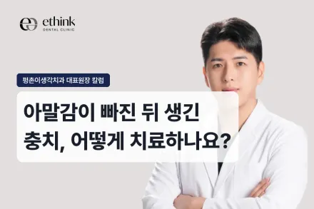 아말감이 빠진 뒤 생긴 충치, 어떻게 치료하나요?