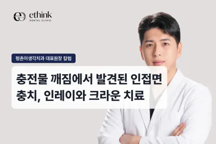 충전물 깨짐에서 발견된 인접면 충치, 인레이와 크라운 치료