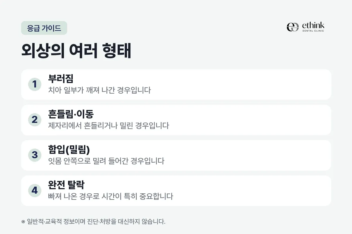부러짐과 흔들림, 함입, 완전 탈락으로 나눈 치아 외상 네 가지 형태를 정리한 카드