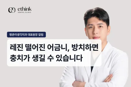 레진 떨어진 어금니, 방치하면 충치가 생길 수 있습니다