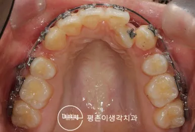뽑은 자리를 어디에 쓰느냐가 계획을 가릅니다