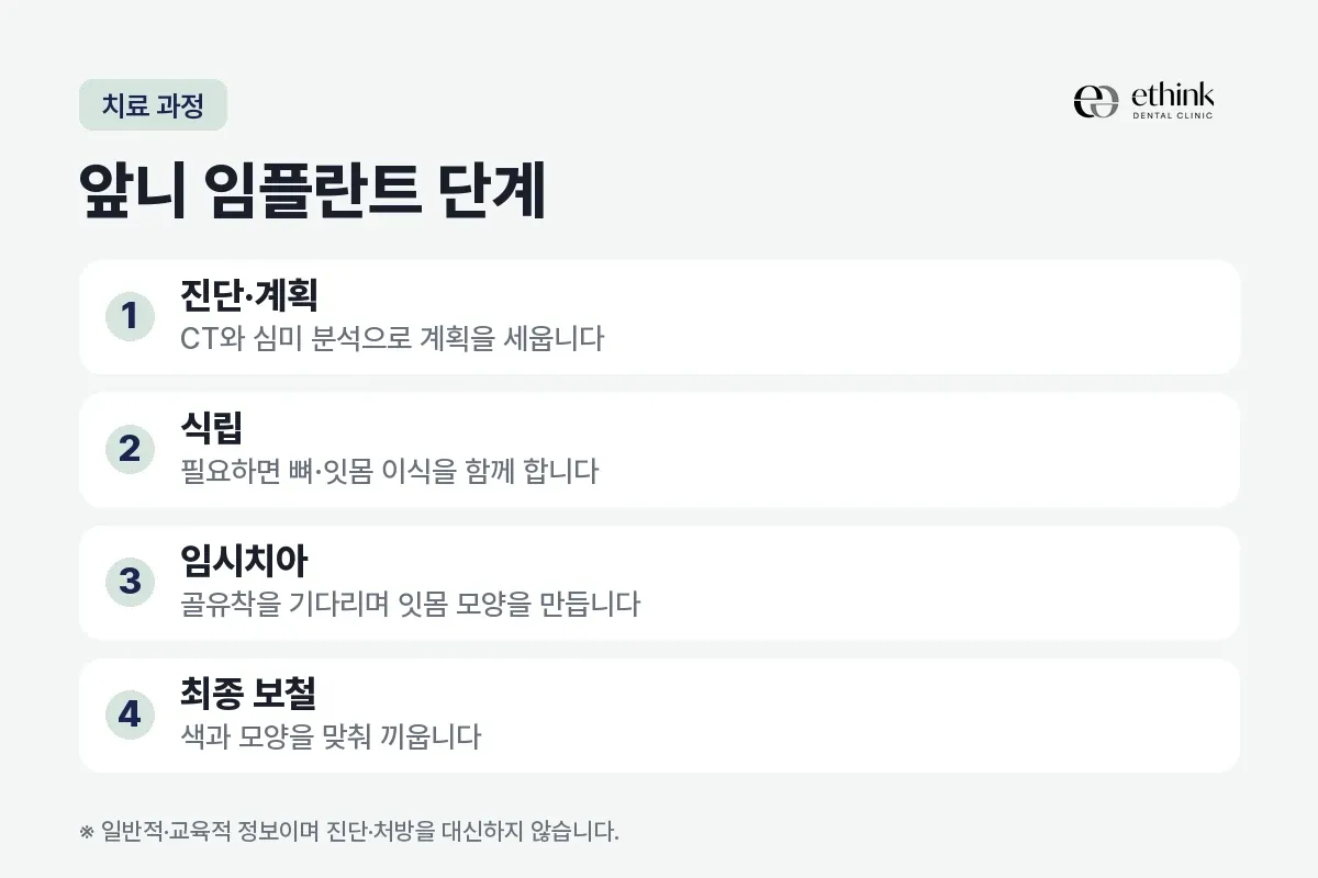 진단·계획, 식립, 임시치아, 최종 보철을 앞니 임플란트의 네 단계로 정리한 카드