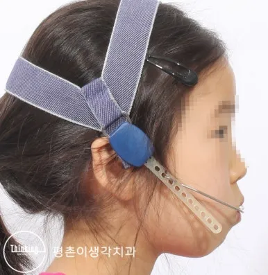 상방견인 헤드기어를 착용한 옆모습