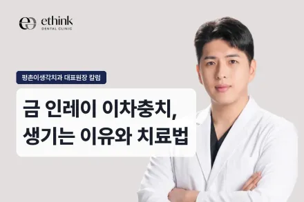 금 인레이 이차충치, 생기는 이유와 치료법