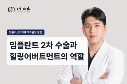 임플란트 2차 수술과 힐링어버트먼트의 역할