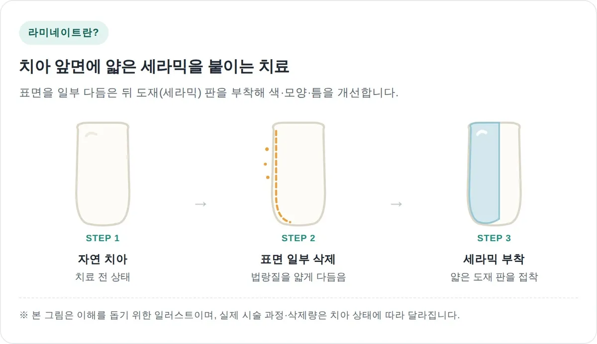 수명을 정하는 것