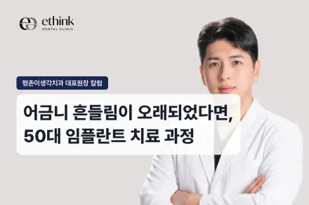 어금니 흔들림이 오래되었다면, 50대 임플란트 치료 과정