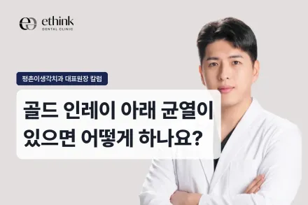 골드 인레이 아래 균열이 있으면 어떻게 하나요?