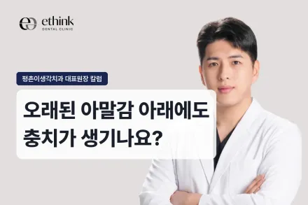 오래된 아말감 아래에도 충치가 생기나요?