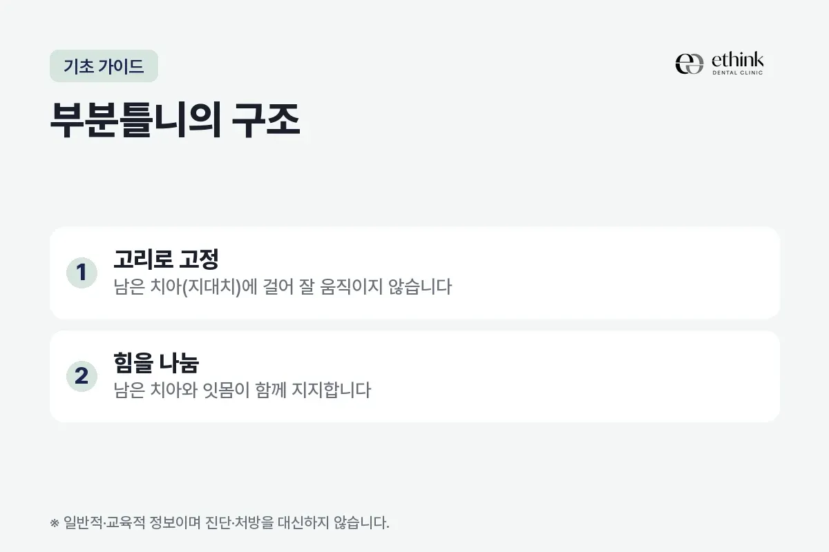 부분틀니가 남은 치아에 고리로 고정되고 잇몸과 힘을 나눠 받는 구조를 정리한 카드
