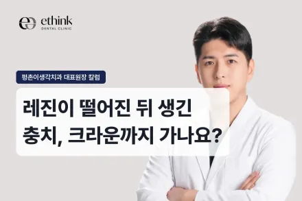 레진이 떨어진 뒤 생긴 충치, 크라운까지 가나요?