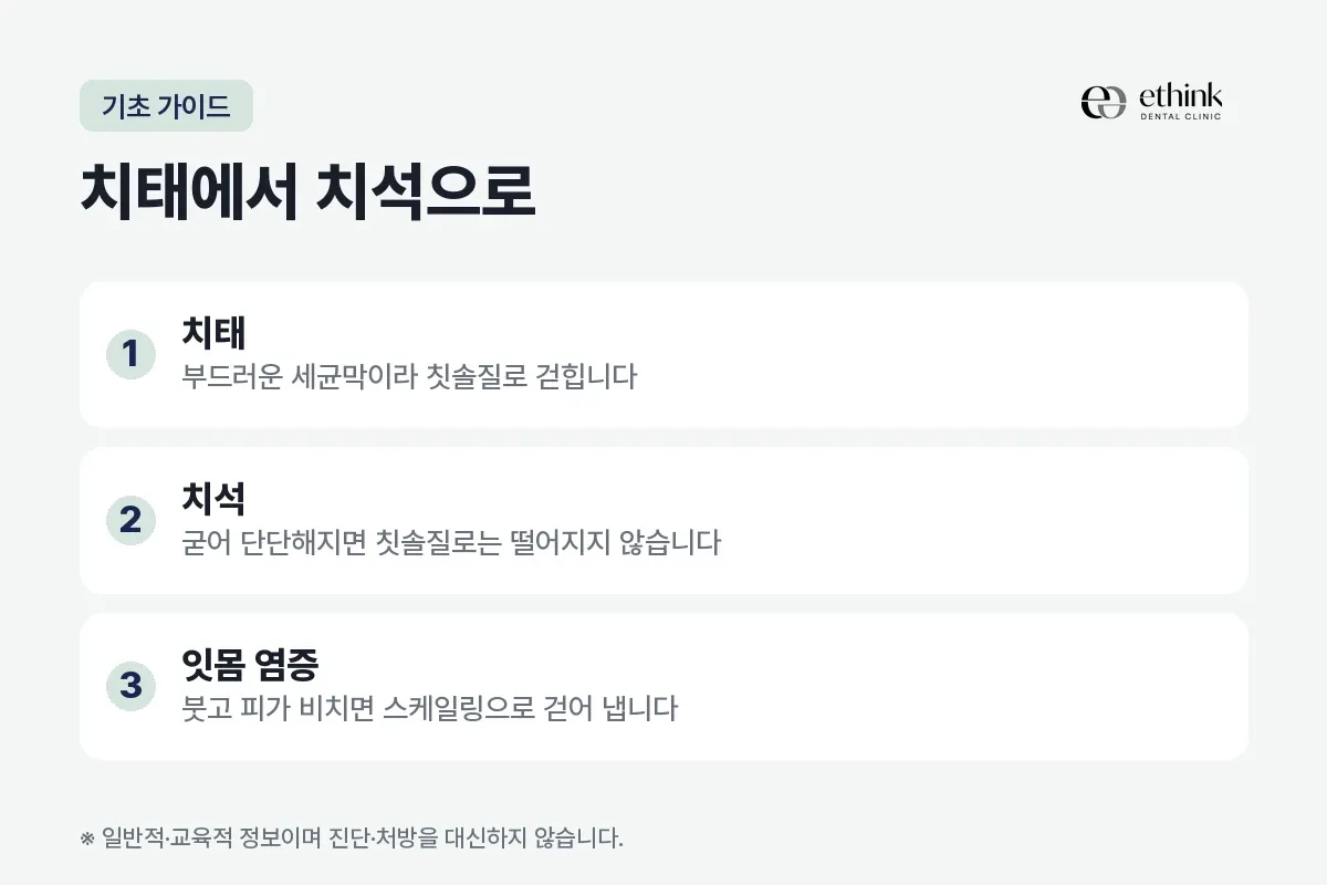 치태, 치석, 잇몸 염증 세 단계를 번호로 적은 카드
