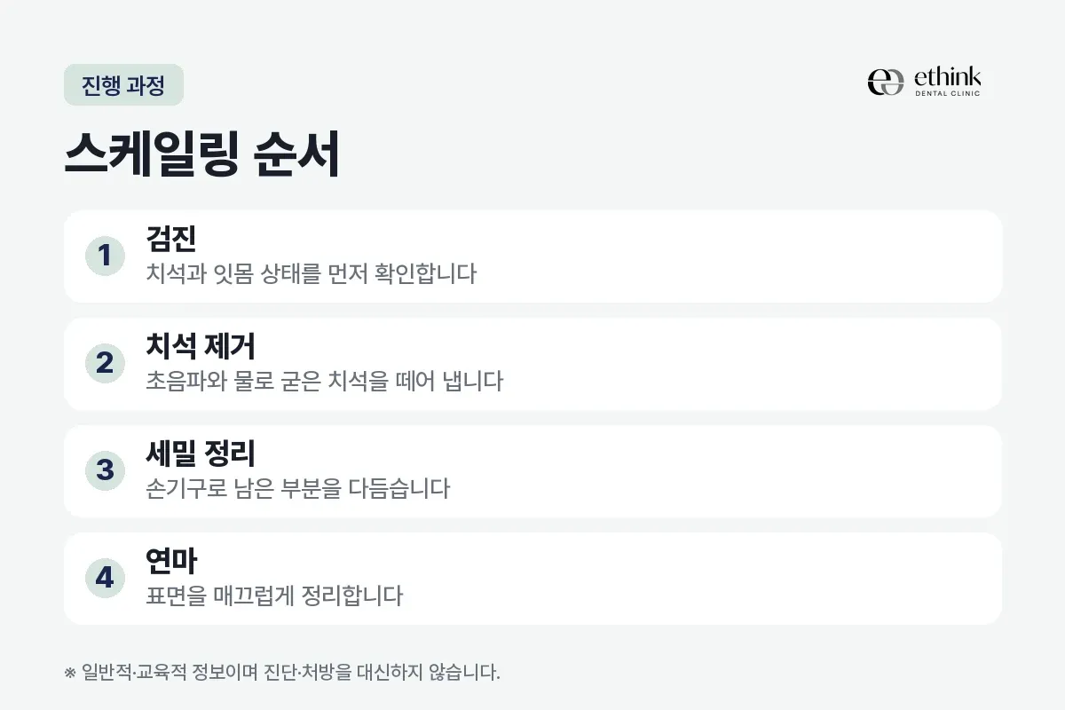 검진, 치석 제거, 세밀 정리, 연마 네 단계를 번호로 적은 진행 순서 카드