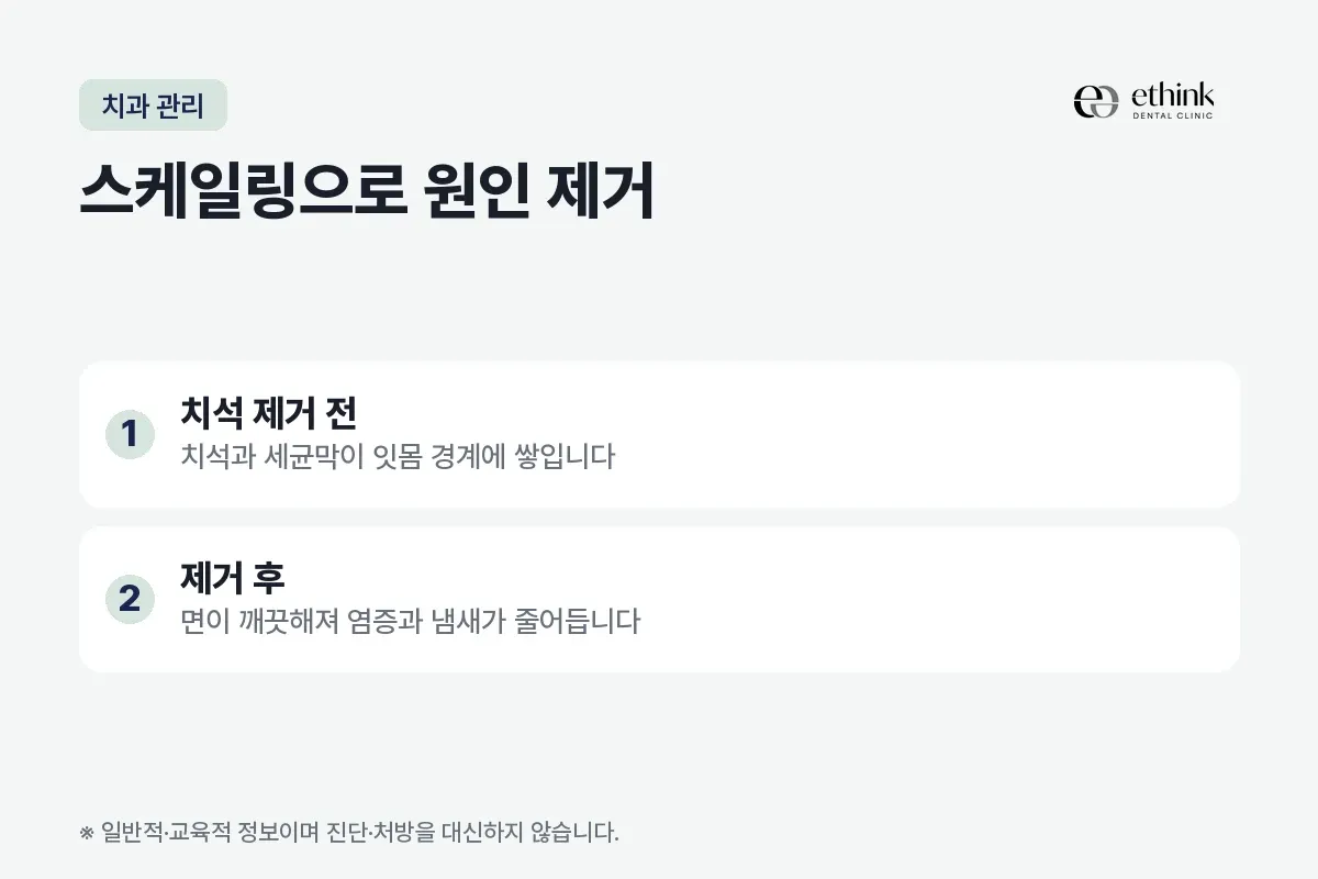 치석 제거 전과 제거 후에 치아면이 어떻게 달라지는지 두 항목으로 정리한 카드